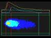 Metafer MetaCyte – Automatic Interphase FISH Analysis